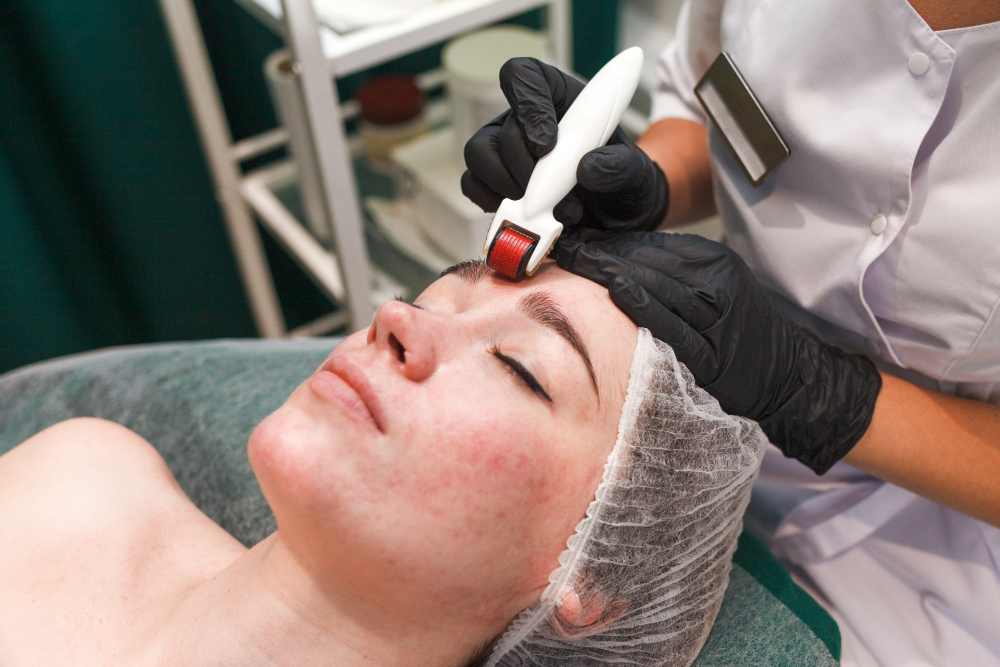 Acne Treatment