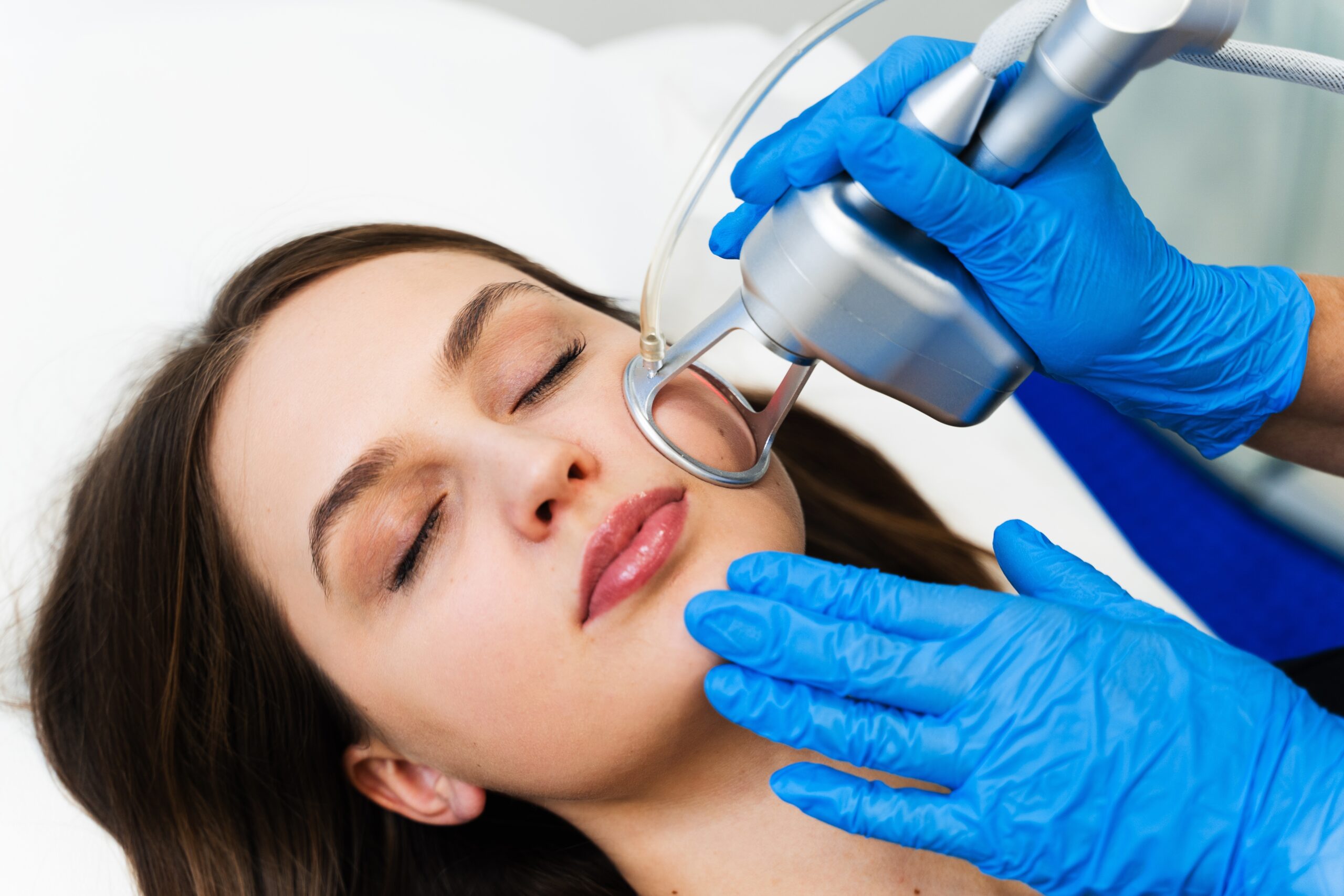 Skin Resurfacing