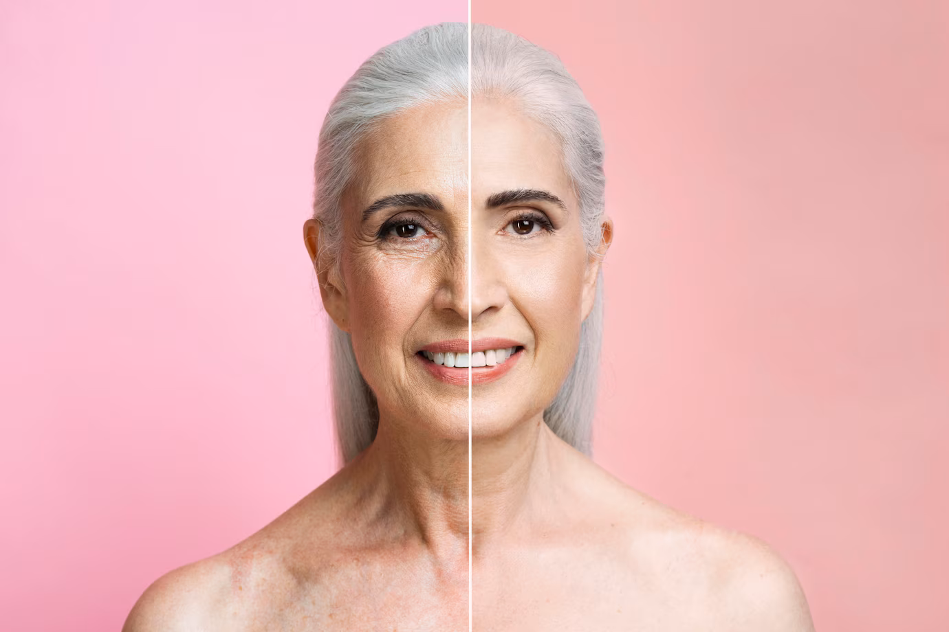 wrinkle reduction
