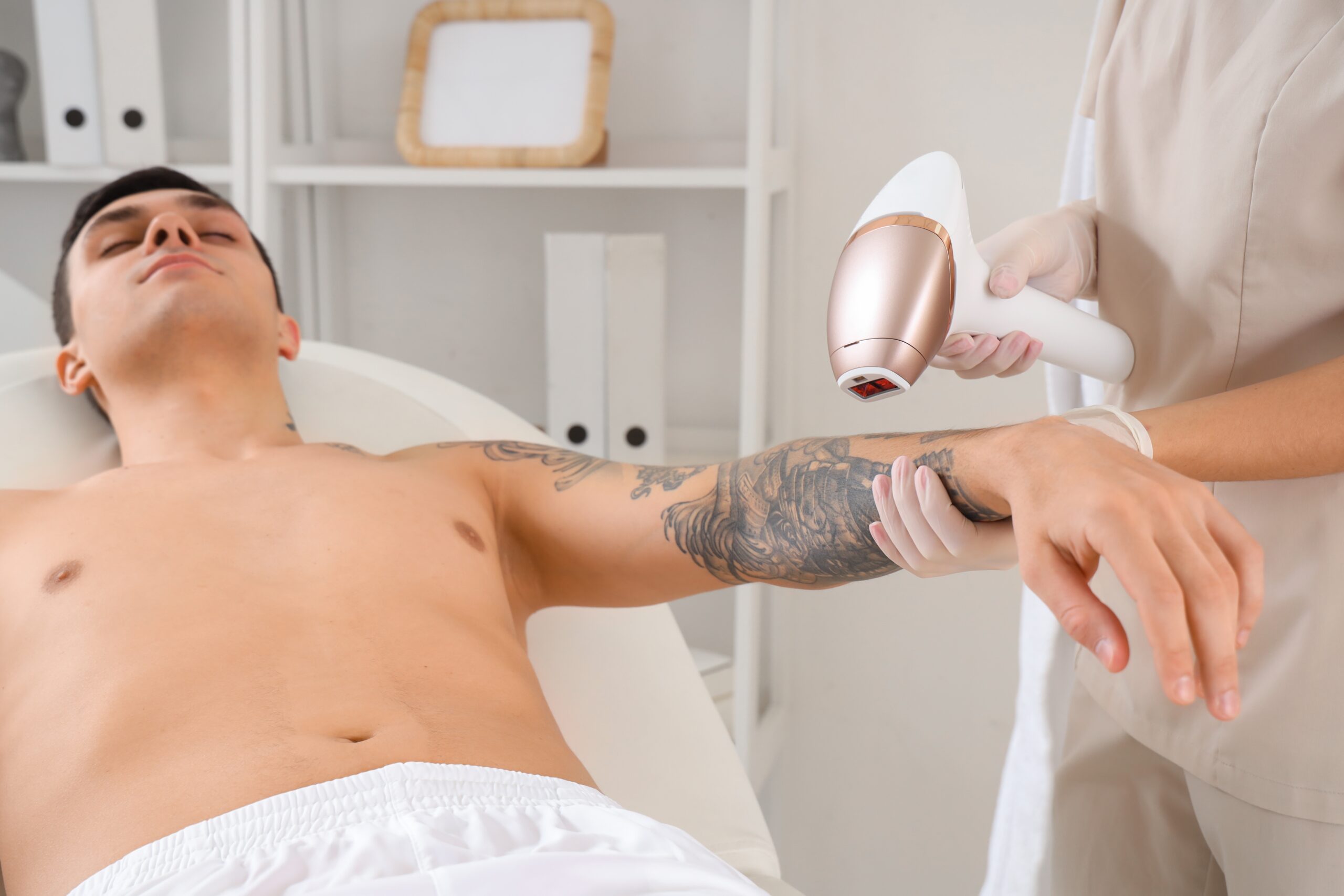 Tattoo Removal