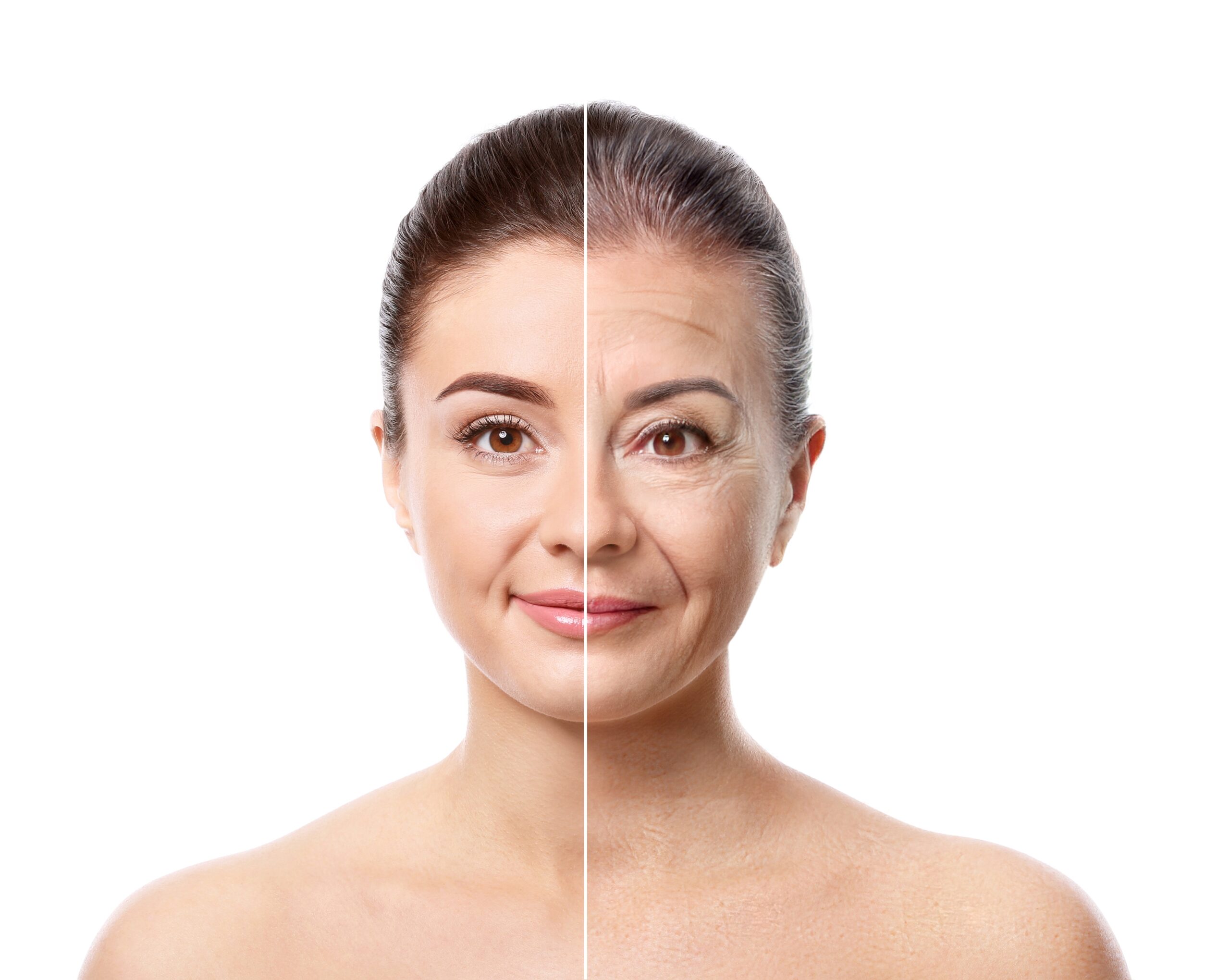 Wrinkle Treatments