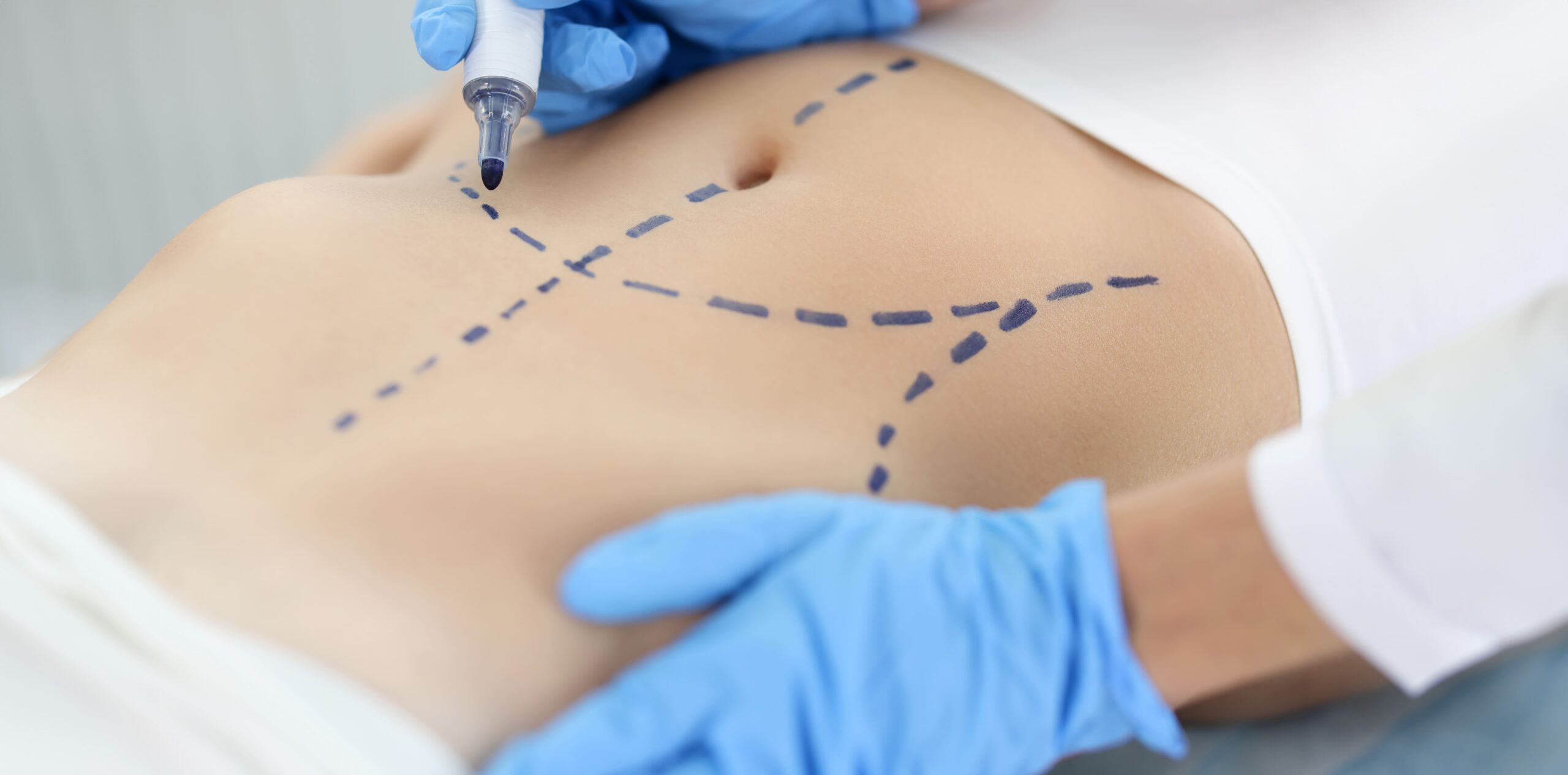 aesthetic treatments
