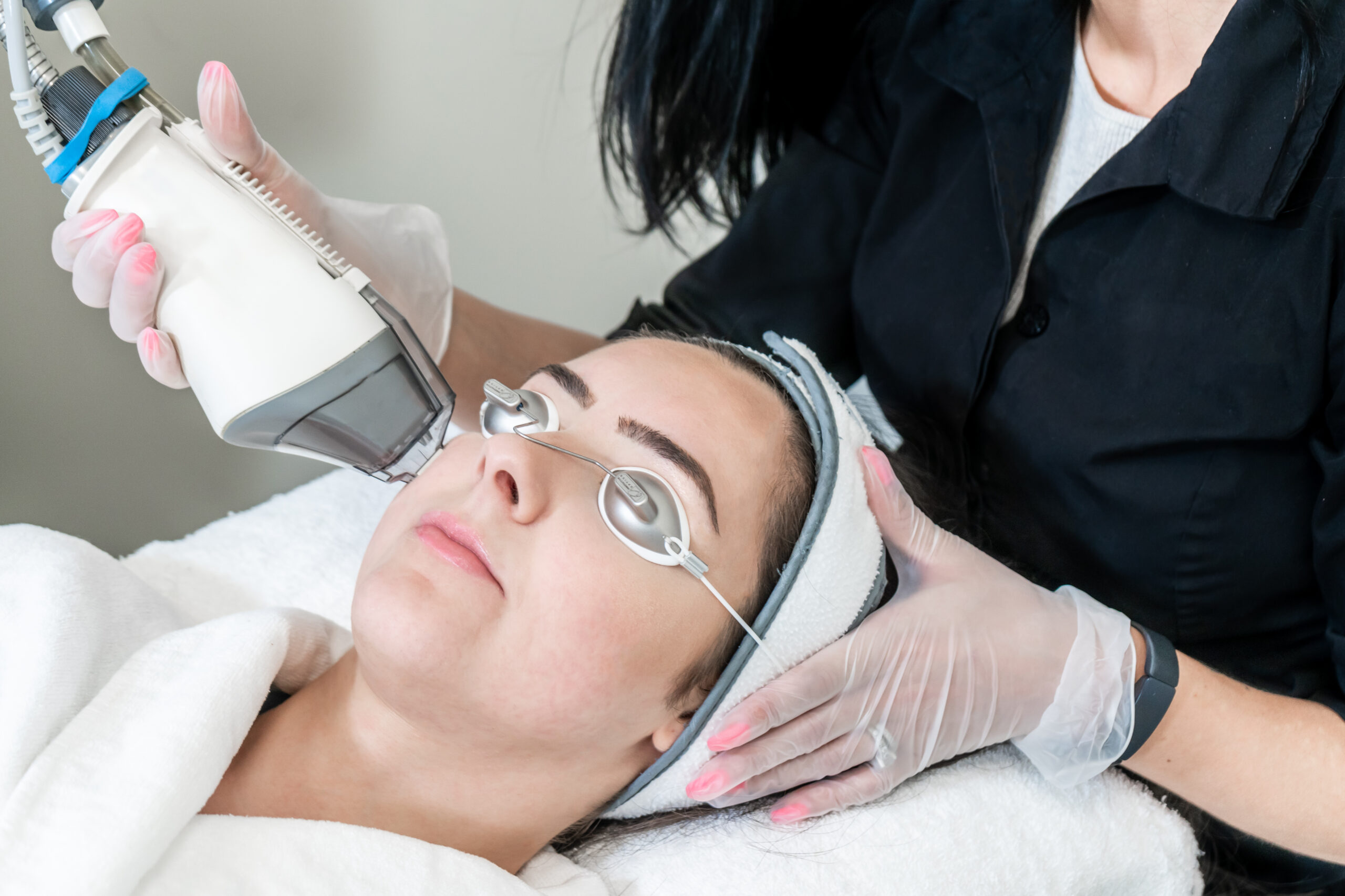 skin resurfacing