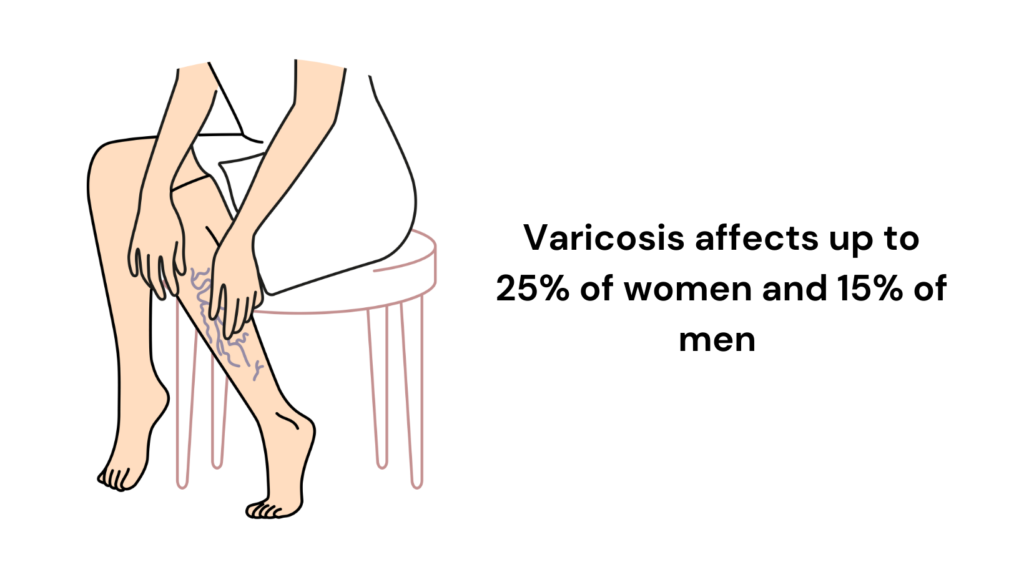 Address Varicose Veins