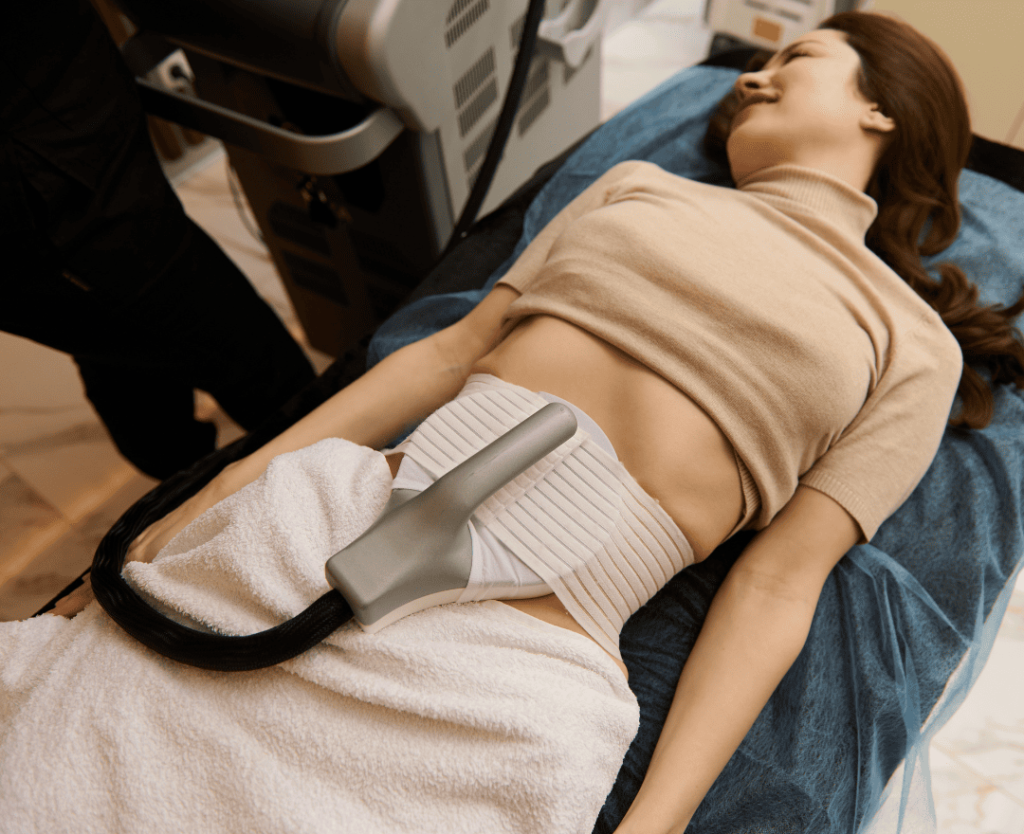 After Laser Liposuction
