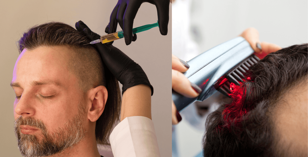 Combining PRP and Laser Therapy
