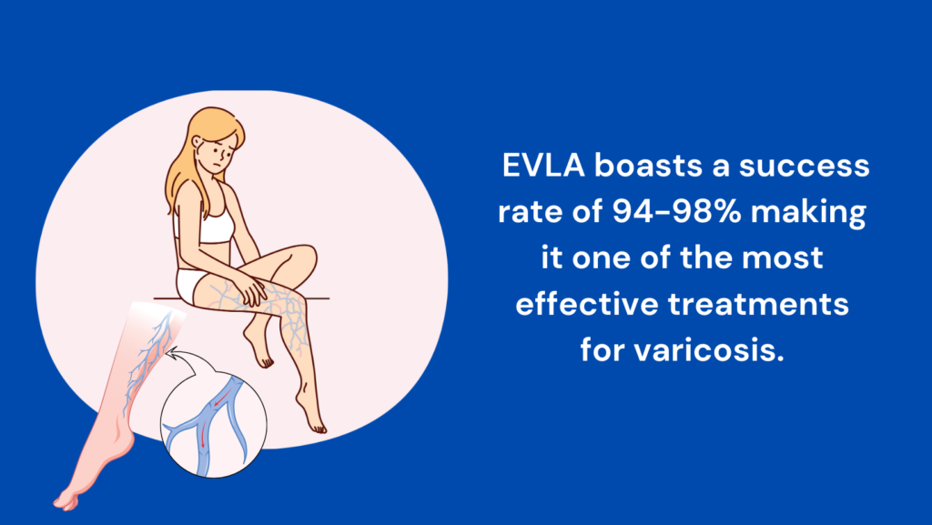 Endovenous Laser Ablation