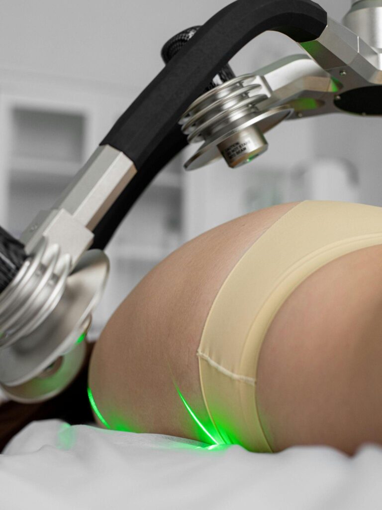 Laser assisted liposuction
