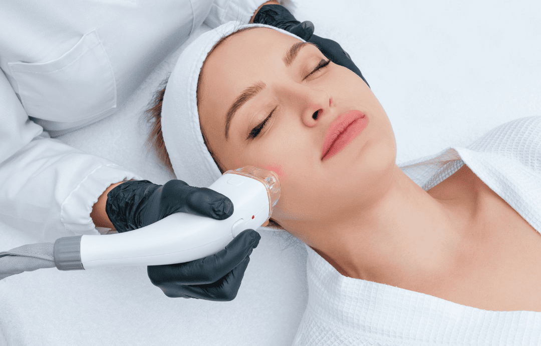 Laser Face-lift Laser Facelift