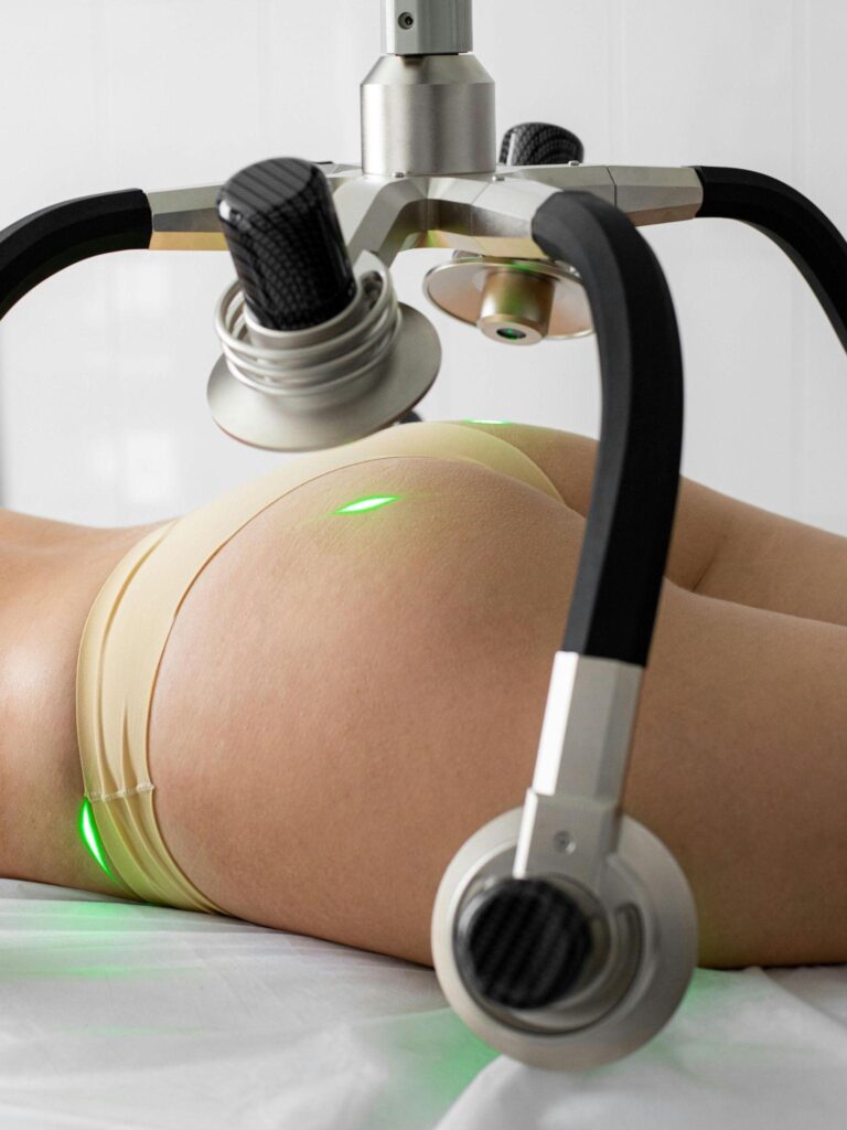 Laser Liposuction vs Liposuction