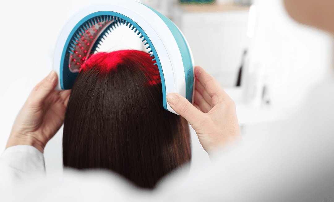 Laser Therapy for Hair Regrowth