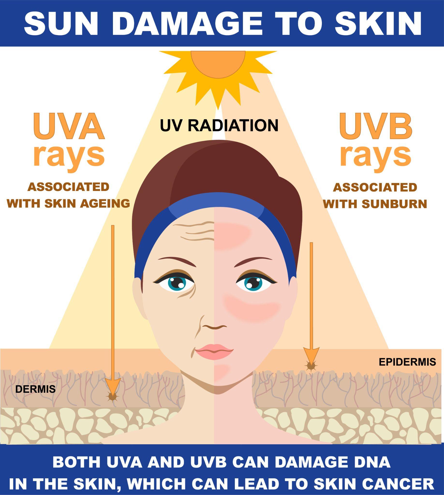 The Role of UVA and UVB Rays