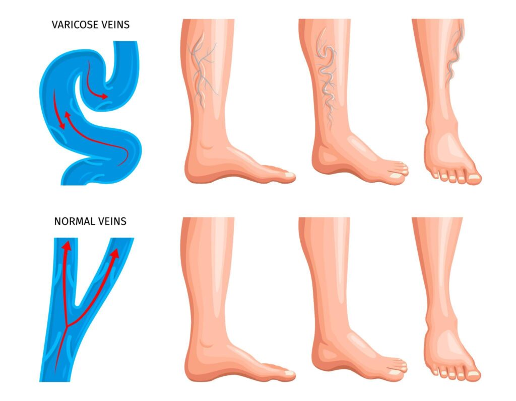 Veins