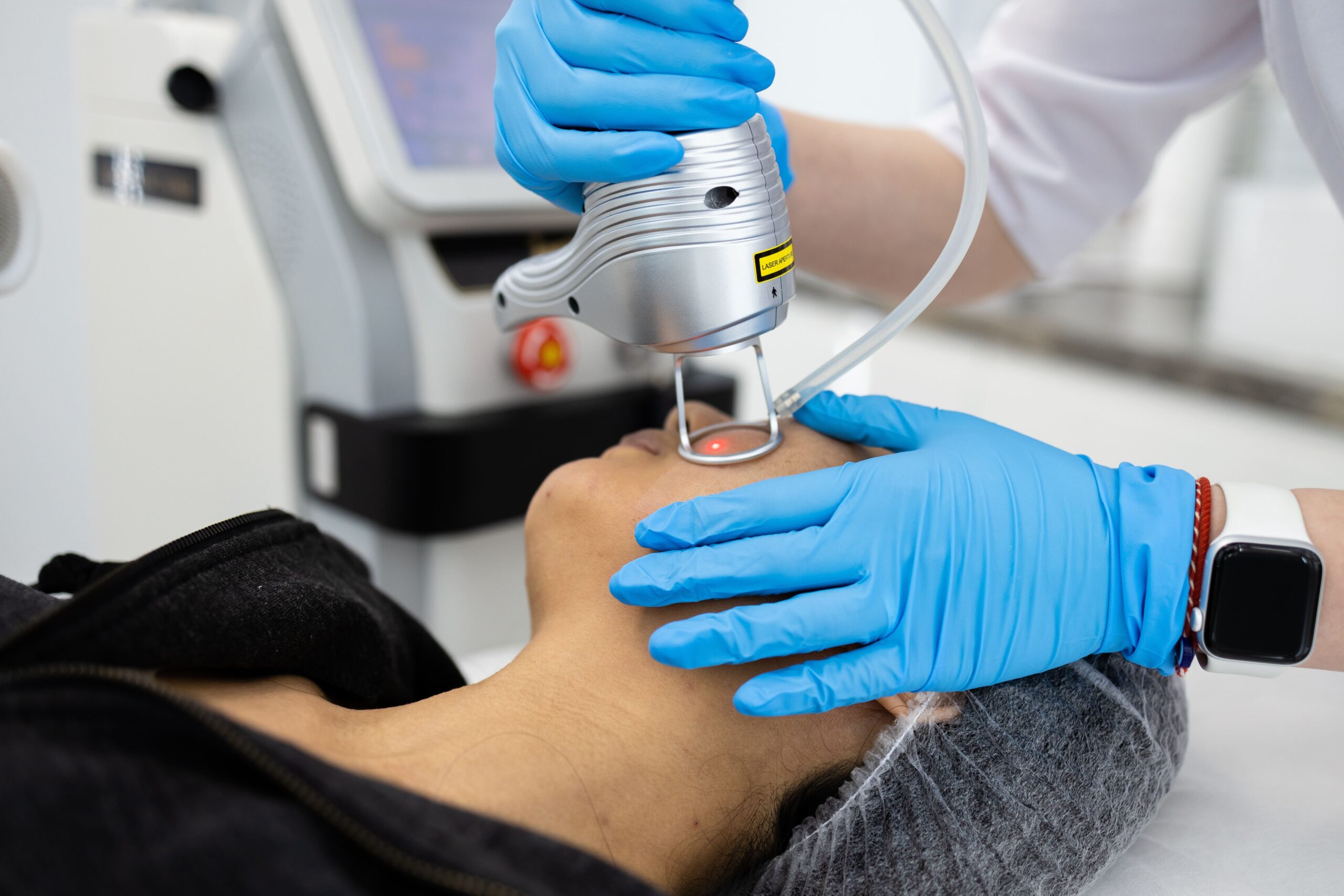 Your Aesthetic Laser Treatments